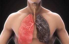 Chronic Obstructive Pulmonary Disease (COPD) Market