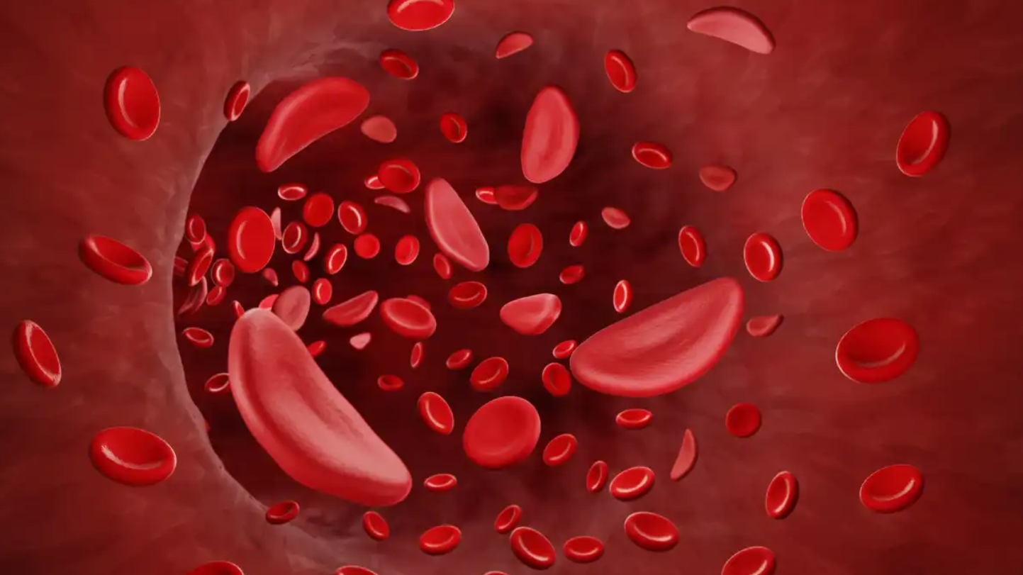 Sickle Cell Disease Treatment Market