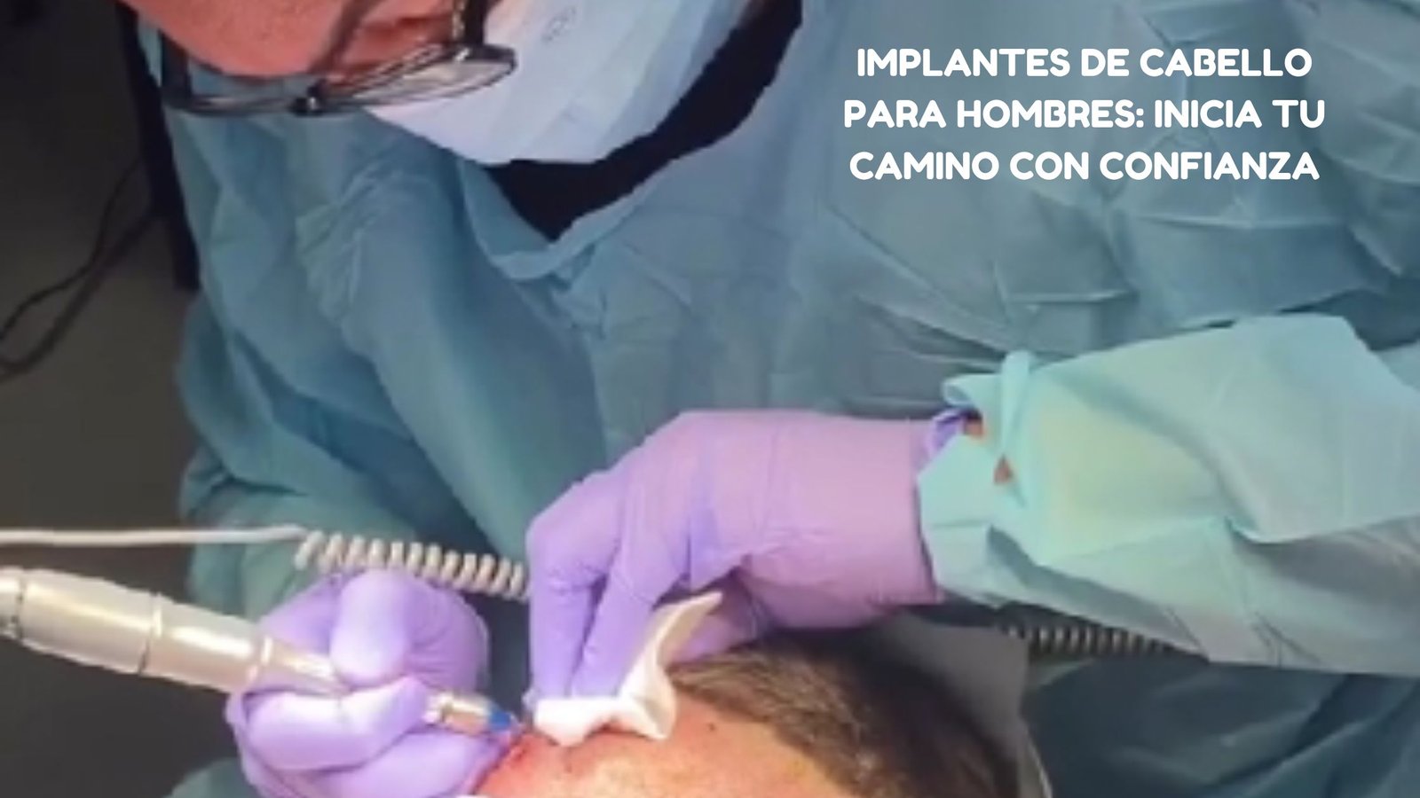 implantes de cabello para hombres