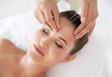 Best Acupuncture Specialists in Redmond