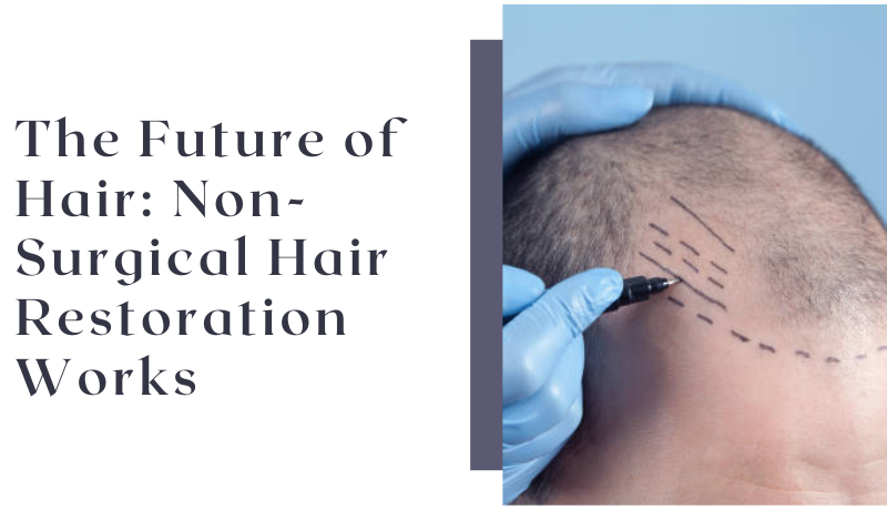 non-surgical hair restoration